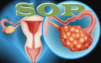 ¿Qué es el SOP – Síndrome de Ovario Poliquístico?