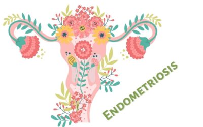 Endometriosis – Causa y manejo nutricional